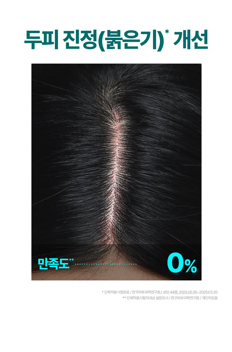 [비듬두피/정수리냄새] 트리셀 안티 댄드러프 샴푸 오션 브리즈 증정 기획(360ml+120ml) 상세페이지 16